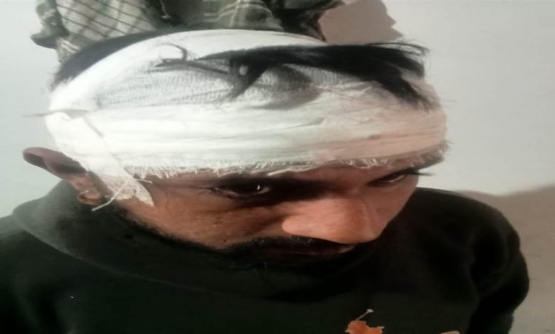 ਸਿਰ 'ਚ ਦਾਤ ਮਾਰ ਕੇ ਰਾਹਗੀਰ ਦਾ ਲੁੱਟਿਆ ਮੋਟਰਸਾਈਕਲ, ਵਾਲ-ਵਾਲ ਬਚੀ ਜਾਨ ਚਾਰ ਬਦਮਾਸ਼ਾਂ ਨੇ ਦਿੱਤਾ ਵਾਰਦਾਤ ਨੂੰ ਅੰਜਾਮ