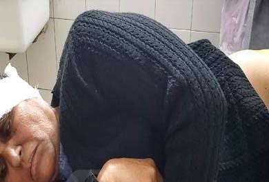 ਬਜ਼ੁਰਗ ਔਰਤ ਨੂੰ ਕੁੱਤਿਆਂ ਨੇ ਘੇਰਾ ਪਾ ਕੀਤਾ ਜ਼ਖ਼ਮੀ
