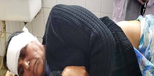 ਬਜ਼ੁਰਗ ਔਰਤ ਨੂੰ ਕੁੱਤਿਆਂ ਨੇ ਘੇਰਾ ਪਾ ਕੀਤਾ ਜ਼ਖ਼ਮੀ