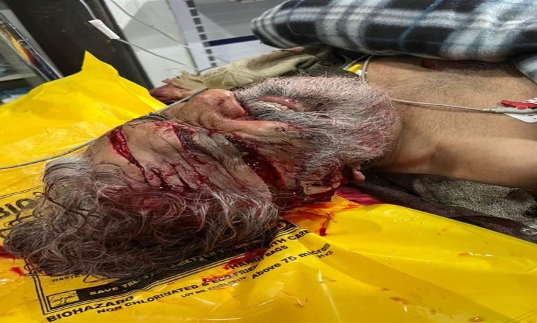 ਆਮ ਆਦਮੀ ਪਾਰਟੀ ਦੇ ਪੰਚਾਇਤ ਮੈਂਬਰ ਦੇ ਭਰਾ ’ਤੇ ਸੁੱਤੇ ਪਿਆਂ ਹਮਲਾ