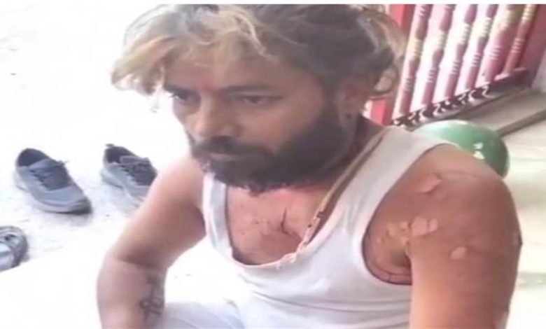 ਕਮੇਟੀ ਦੇ ਪ੍ਰਧਾਨ ਨਾਲ ਝਗੜੇ ਤੋਂ ਬਾਅਦ ਪੁਜਾਰੀ ਨੇ ਖ਼ੁਦ ਨੂੰ ਲਾਈ ਅੱਗ, ਹਸਪਤਾਲ ਦਾਖ਼ਲ