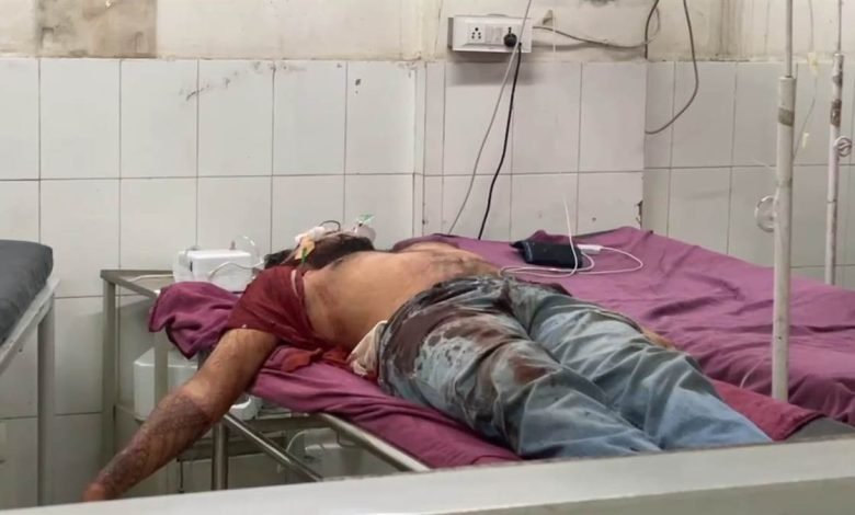 ਖੰਨਾ 'ਚ ਦੋ ਗੁੱਟਾਂ 'ਚ ਹੋਈ ਗੋਲੀਬਾਰੀ, ਇੱਕ ਨੌਜਵਾਨ ਜ਼ਖਮੀ; ਇਲਾਕੇ 'ਚ ਦਹਿਸ਼ਤ ਦਾ ਮਾਹੌਲ