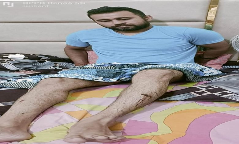 ਮਾਡਲ ਟਾਊਨ ’ਚ ਆਵਾਰਾ ਕੁੱਤਿਆਂ ਨੇ ਜਿਮ ਟ੍ਰੇਨਰ ’ਤੇ ਹਮਲਾ ਕੀਤਾ ਮਾਡਲ ਟਾਊਨ ’ਚ ਆਵਾਰਾ ਕੁੱਤਿਆਂ ਨੇ ਜਿਮ ਟ੍ਰੇਨਰ ’ਤੇ ਹਮਲਾ ਕੀਤਾ