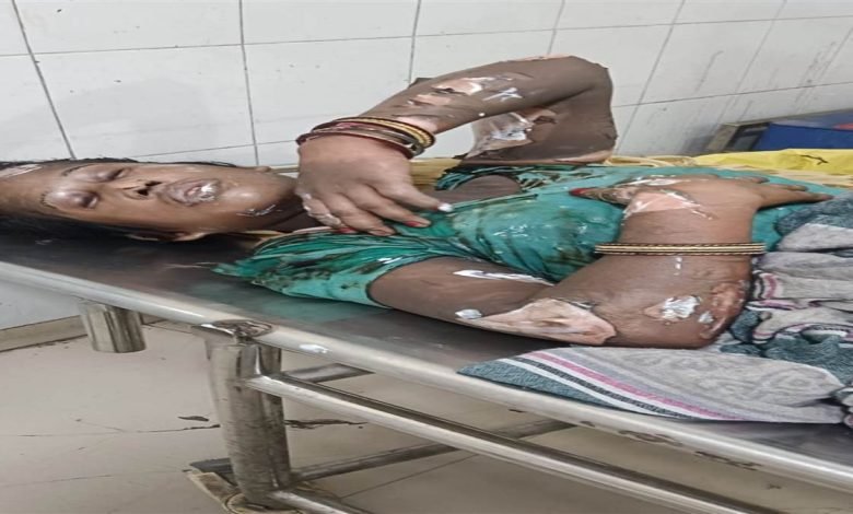 ਘਰੇਲੂ ਗੈਸ ਸਿਲੰਡਰ ਫਟਿਆ, ਪਤੀ-ਪਤਨੀ ਬੁਰੀ ਤਰਾਂ ਝੁਲਸੇ