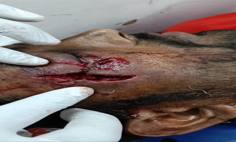 ਮੋਬਾਈਲ ਲੁੱਟਣ ਲਈ ਬਦਮਾਸ਼ਾਂ ਨੇ ਤੇਜ਼ਧਾਰ ਹਥਿਆਰਾਂ ਨਾਲ ਕੀਤਾ ਹਮਲਾ