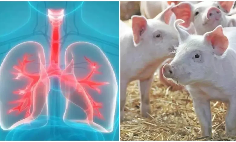ਚੀਨ ਦੇ ਡਾਕਟਰਾਂ ਦਾ ਚਮਤਕਾਰ, ਸੂਰ ਦੇ ਫੇਫੜੇ ਮਨੁੱਖ 'ਚ ਕੀਤੇ ਟ੍ਰਾਂਸਪਲਾਂਟ
