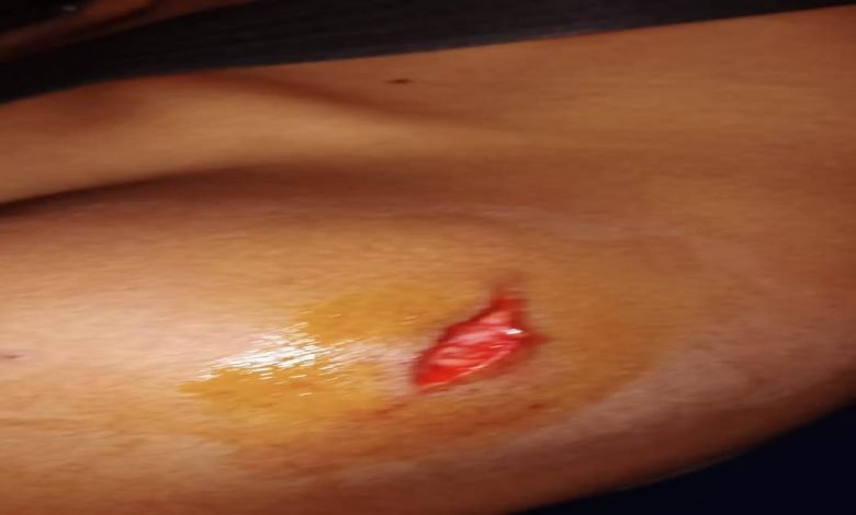 ਤਲਵਾਰ ਨਾਲ ਵਾਰ ਕਰ ਕੇ ਰਾਹਗੀਰ ਲੁੱਟਿਆ, 2 ਅੜਿੱਕੇ ਤਲਵਾਰ ਨਾਲ ਵਾਰ ਕਰ ਕੇ ਰਾਹਗੀਰ ਲੁੱਟਿਆ, 2 ਅੜਿੱਕੇ