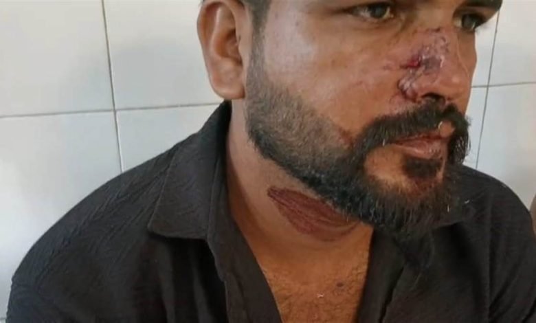 ਪਿੰਡ ਛੱਤ ’ਚ ਦੋ ਧਿਰਾਂ ਵਿਚਾਲੇ ਖ਼ੂਨੀ ਝੜਪ, 9 ਜ਼ਖ਼ਮੀ ਪਿੰਡ ਛੱਤ ’ਚ ਦੋ ਧਿਰਾਂ ਵਿਚਾਲੇ ਖ਼ੂਨੀ ਝੜਪ, 9 ਜ਼ਖ਼ਮੀ