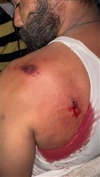 ਨਸ਼ਾ ਵੇਚਣ ਤੋਂ ਰੋਕਣ ਦੀ ਕੋਸ਼ਿਸ਼ ਕਰਨ 'ਤੇ ਇੱਕ ਨੌਜਵਾਨ ਨੂੰ ਮਾਰੀ ਗੋਲੀ