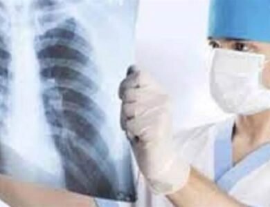 ਚੰਡੀਗੜ੍ਹ ’ਚ ਵਧ ਰਿਹਾ ਟੀਬੀ ਦਾ ਖ਼ਤਰਾ