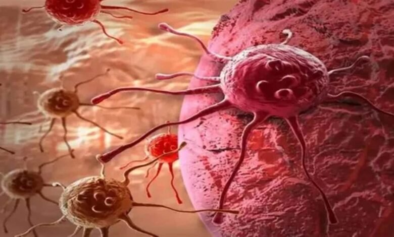 ਪੰਜਾਬ ਦੀਆਂ ਔਰਤਾਂ 'ਤੇ ਕੈਂਸਰ ਦਾ ਸਾਇਆ